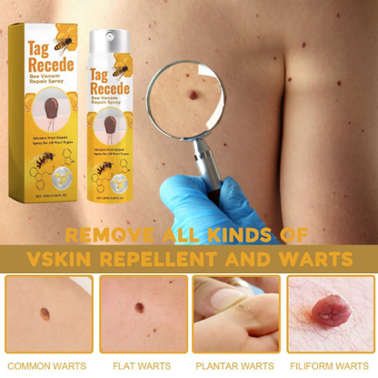 TECNOFEX Bee Venom Skin Tag Removal Cream Spray