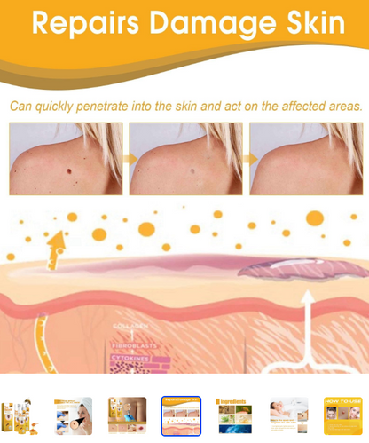 TECNOFEX Bee Venom Skin Tag Removal Cream Spray